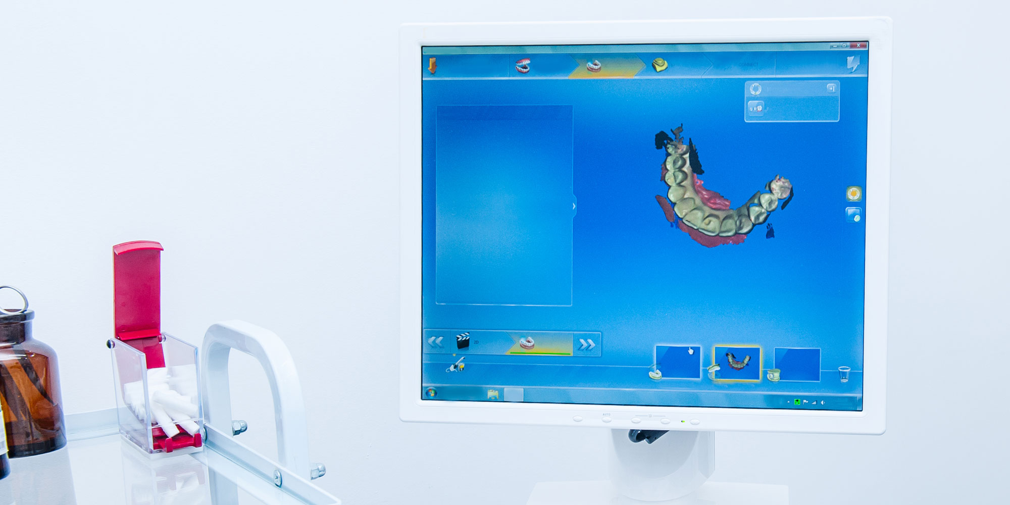 cerec machine Lafayette IN